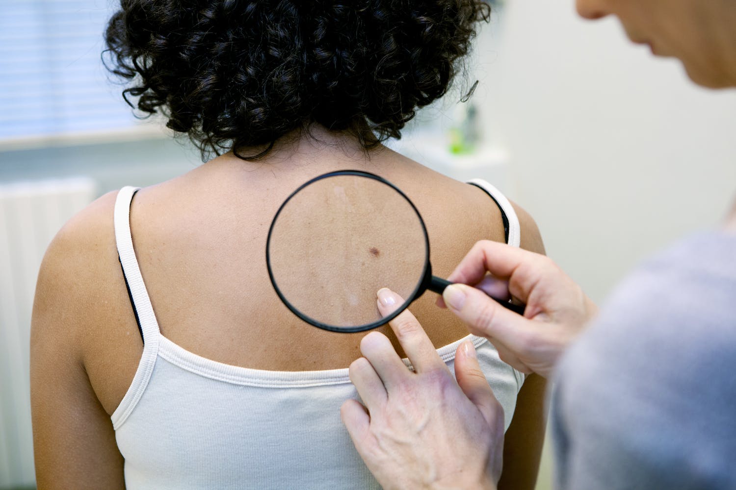 5 choses à savoir sur le mélanome