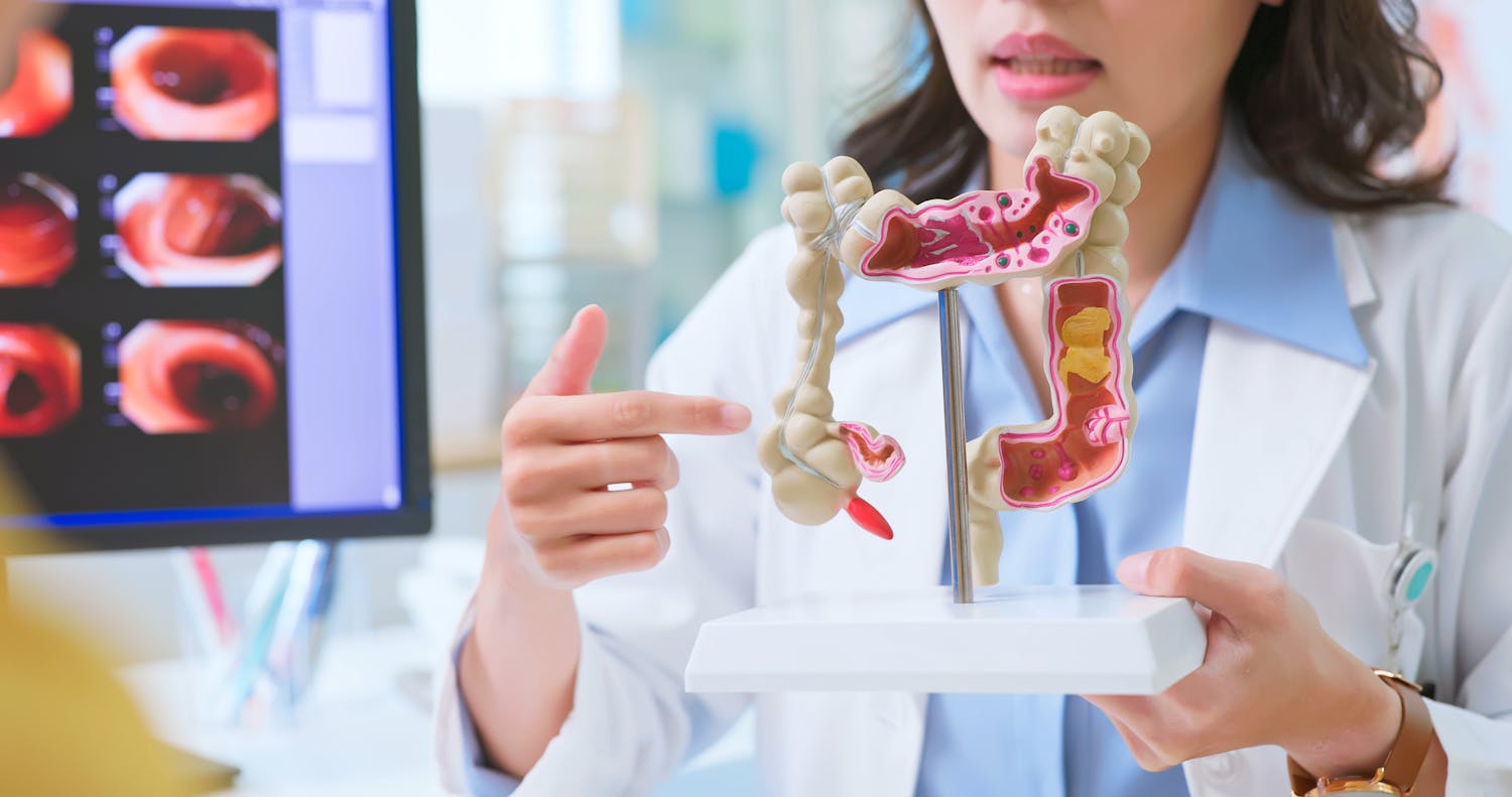 Cancer du côlon : quelles sont les causes ?