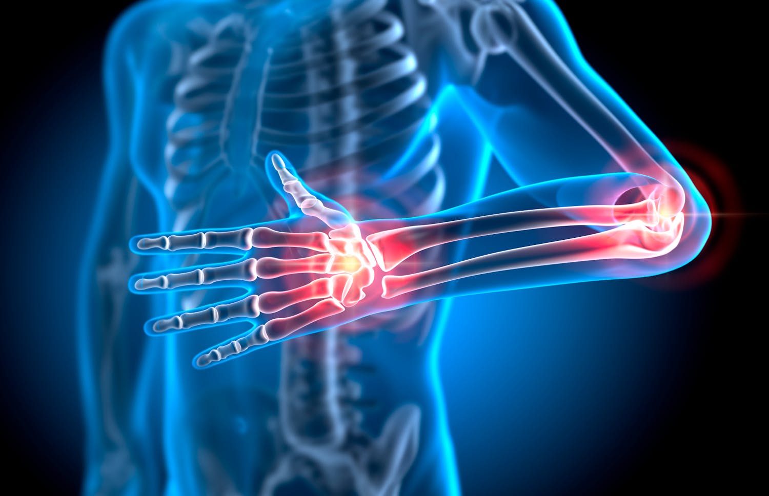 Le cubitus, un os plus important qu'on ne le pense