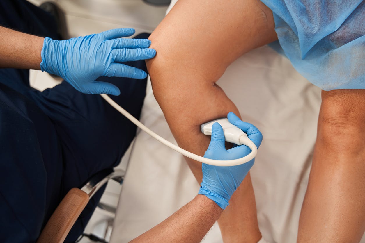 Écho-doppler : à quoi sert cet examen ?