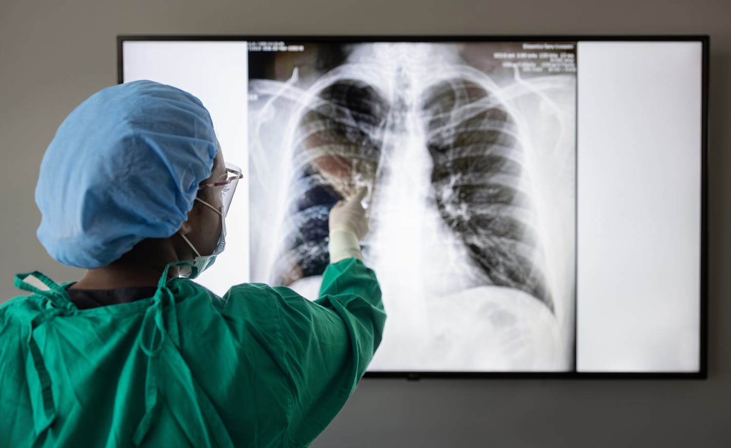 Situs inversus : quand les organes sont inversés, faut-il s'inquiéter ?